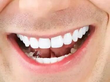 简单恢复牙龈萎缩的方法是什么(简单的恢复牙龈萎缩方法)