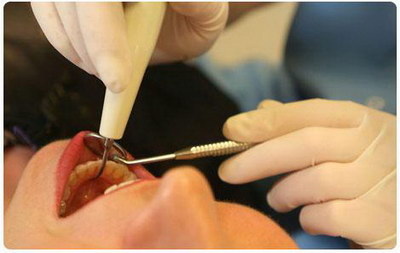 嵌体可以保护根管治疗之后的牙吗_根管治疗要治疗多少次要多长时间