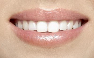 牙齿树脂填充图片「牙齿树脂填充可以维持多久」