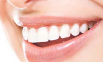 牙齿整形需要多长时间[牙齿整形后需要恢复多长时间]