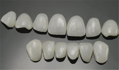 牙齿矫正打骨钉后多久可以取下「牙齿矫正支抗钉多久可以取下来」