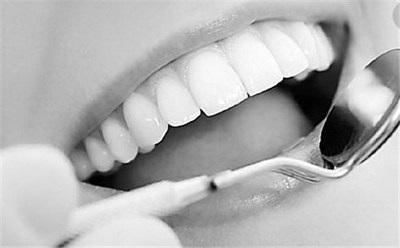 牙齿不白的原因【牙齿很黄刷不白是牙结石的原因吗】