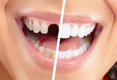 根管治疗牙齿痛缓解_根管治疗牙齿痛可以吃布洛芬吗