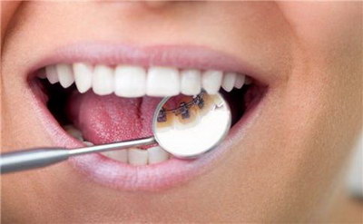 构成骨骼和牙齿的主要成分_倒数第二个牙齿是什么牙齿