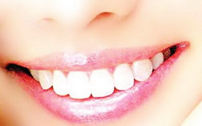牙齿出血是什么问题吃什么药_牙齿总是出血什么问题