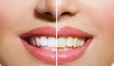 牙根管治疗过程「牙根管治疗过程讲解」