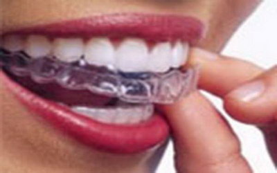 牙齿酸是什么原因引起的[请问一下牙齿出血是什么原因引起的]