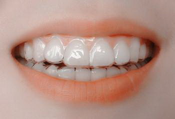 中年人牙齿松动吃什么钙片(中年人牙齿松动是什么原因引起的)