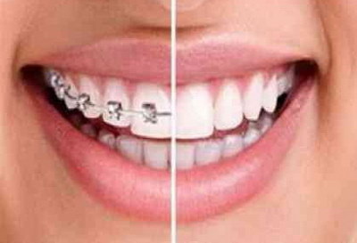 儿童换牙齿生长时间表