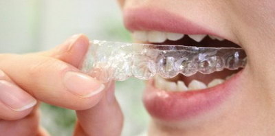 半全口种植牙要多久能适应_北京全口种植牙能用多少年