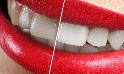 牙齿不好是什么原因总是蛀牙[牙齿长期痛不好是什么原因呢]