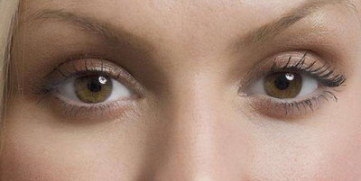 双眼皮修复效果怎么样还会自然吗「埋线双眼皮修复效果怎么样」