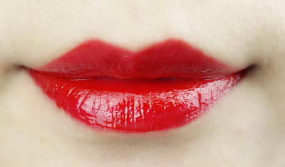 女性唇腭裂遗传几率