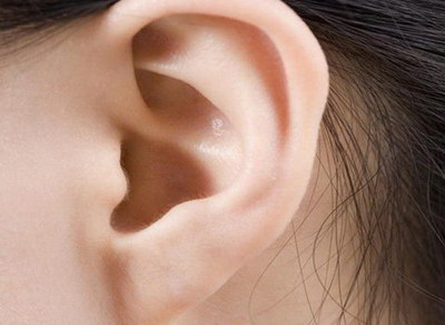双侧小耳畸形有听力吗