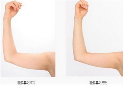 女生手臂肌肉图片「女生手臂肌肉线条」