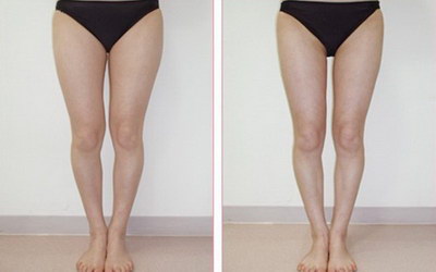 如何瘦大腿效果最明显「如何瘦大腿效果最快女生」