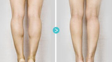 减大腿最好的方法「减大腿和臀部的最好的运动方法」