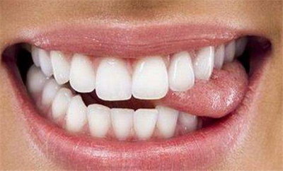 吸烟牙黄刷牙能变白吗