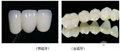 吸附性义齿和活动义齿的区别_吸附性义齿的牙托是什么材料