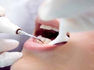 西安牙齿医院诺贝尔牙科(西安诺贝尔牙科矫正牙齿怎么样)