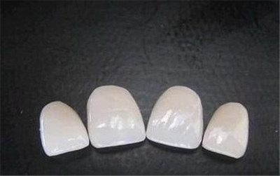 农村医疗保险种植牙可以报销吗_北京70多岁老人可以种植牙吗