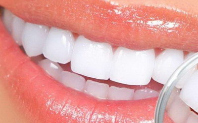 怎么保养保健牙齿