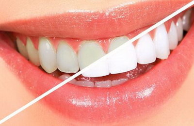 儿童牙齿蛀牙治疗疼不疼