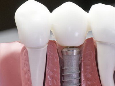 牙齿黄能通过刷牙变白么「牙齿黄能通过刷牙变白吗」