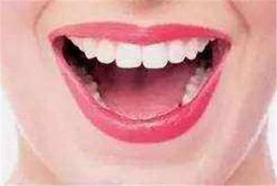嘴里的牙齿长得不对称(为什么会出现不对称的牙齿)