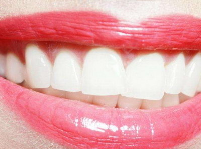 牙黄牙齿上有黑渍是什么(牙黄牙齿上有白白的东西)
