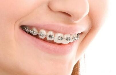光固化补牙能维持多久_光固化补牙的方法步骤