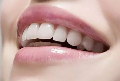 洗牙可以美白牙齿么[洗牙和美白牙齿可以同一天进行吗]
