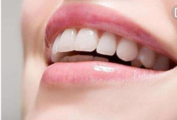 牙齿上黑黑的是蛀牙吗(牙齿里黑黑的是蛀牙吗)