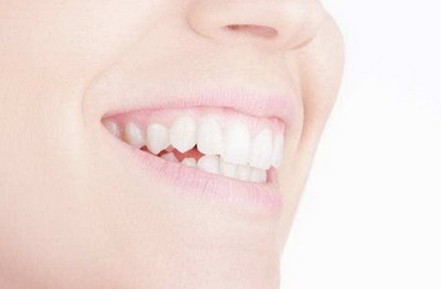 口干口苦牙齿出血是什么原因_前面几个牙齿表面变得有点黑