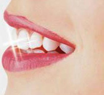 牙齿贴片对牙齿伤害大吗[贴片美牙对牙齿有没有伤害]