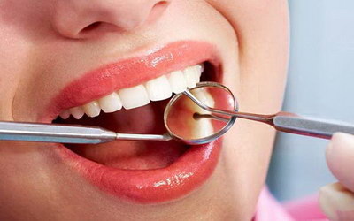 根管治疗后刷牙酸痛什么原因