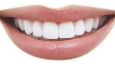 钢牙套和隐形牙套区别(隐形牙套和钢牙套的区别)