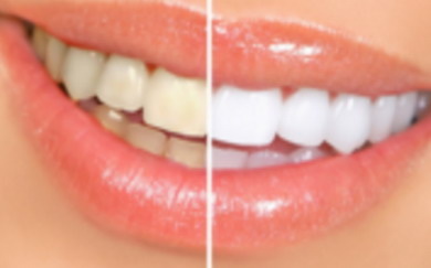 吃什么药能防止牙龈萎缩