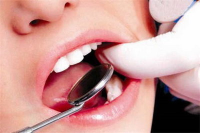 超声波洗牙教程技巧视频_超声波洗牙洁牙全过程