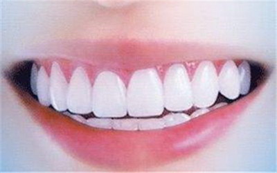 成人矫正牙齿要多长时间_成人矫正牙齿要多长时间复诊一次
