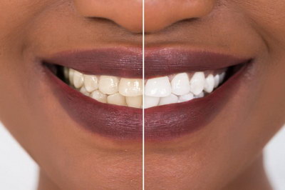 牙齿根管治疗失活剂_牙齿根管治疗时长