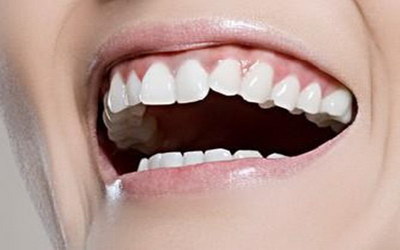 完美牙齿的必要：全口种植牙的优势