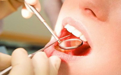 蛀牙对怀孕有影响吗(为什么会有蛀牙)