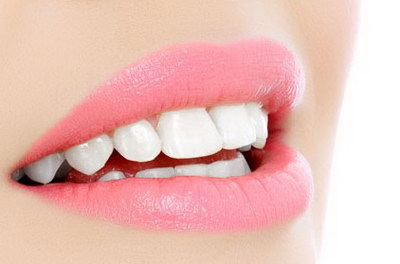 牙套和牙嵌体哪个比较好呢