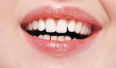 牙齿变黄怎么办才能变白_牙齿有异味怎么办才能去掉