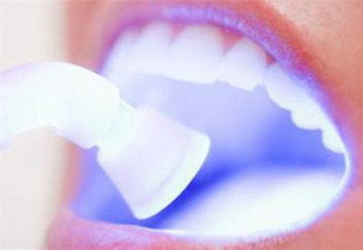 种植牙一颗牙齿能换吗「种植牙一颗牙齿多久能长好」