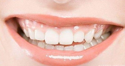 镶牙都有什么材质的「镶牙选择什么材质好」