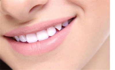 牙贴片什么牌子的好_牙套和牙贴片有什么区别