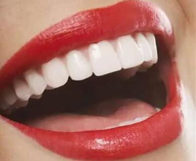 上牙包下牙叫什么「上牙包下牙是什么原因导致的」