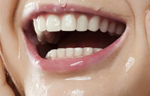 让牙齿变白是什么项目_牙齿变白做什么项目好